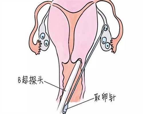 2026年优质辅助生殖医院指南：费用预估与成功率解析