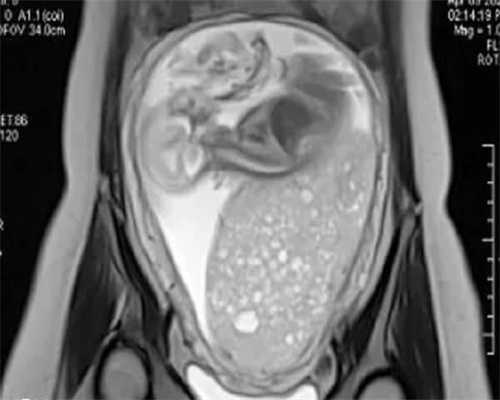 人工授精失败的三大先兆，人工授精失败原因有哪些