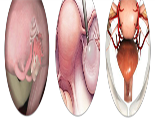 
              许昌正规医院做一次试管婴儿费用大约多少钱？
