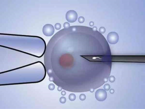 新生儿耳廓畸形：非手术矫正新希望