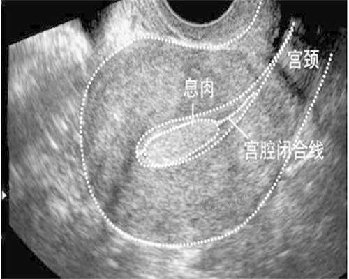 奶粉开封后多久不宜继续饮用？营养流失与变质风险解析
